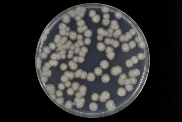 Bacterial colonies grown on agar plate (Bacillus subtilis)